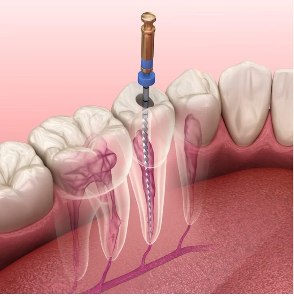 92f93721 6da6 4051 b154 87d96cfc8f3d 92f93721 6da6 4051 b154 87d96cfc8f3d